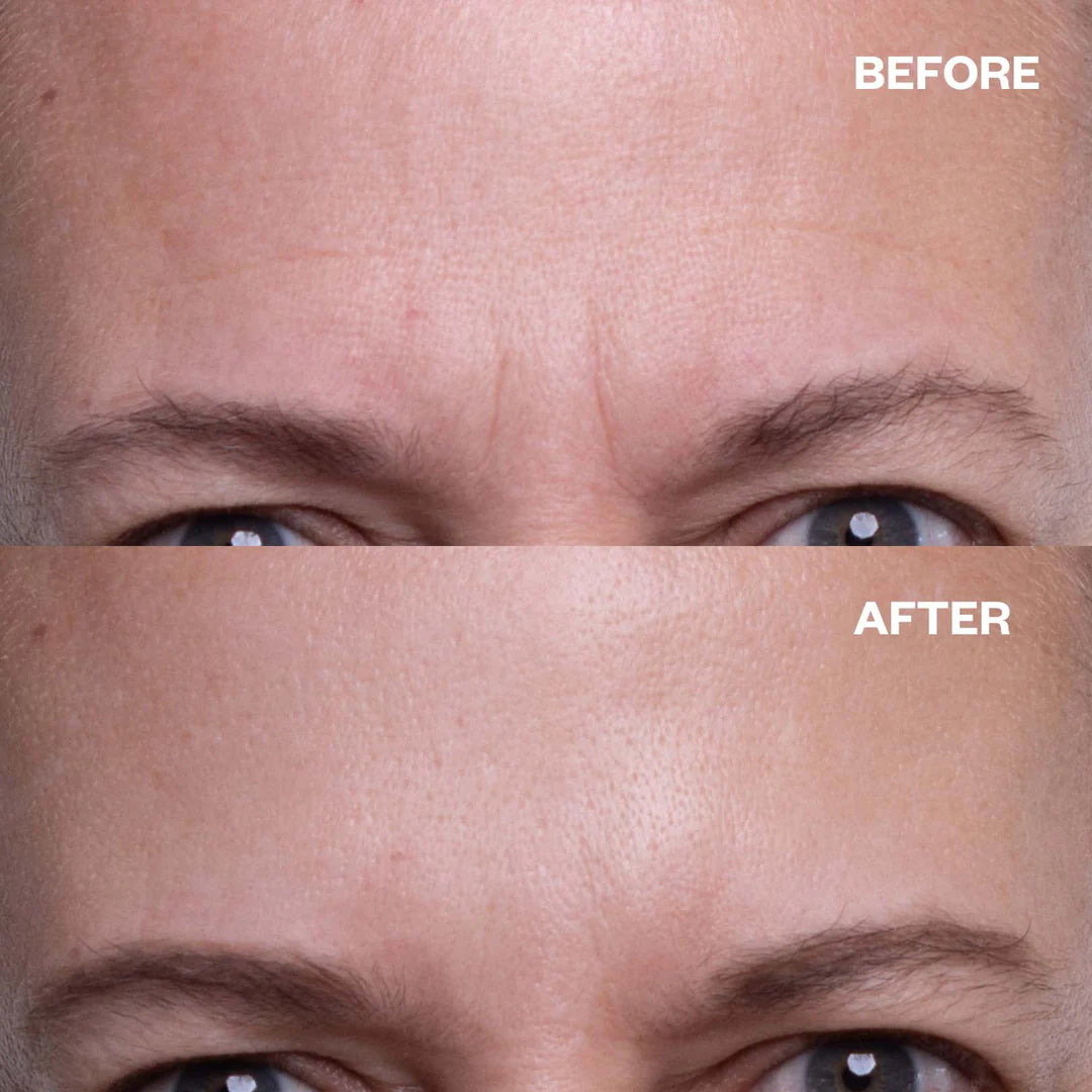ws_forehead_results