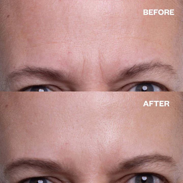 ws_forehead_results