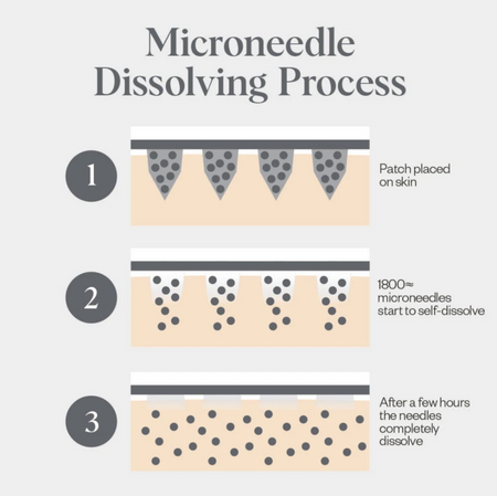 Self-Dissolving Microneedle Patches - Single Pouch