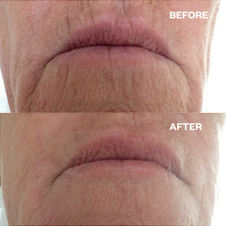 before_after_mouthpatch