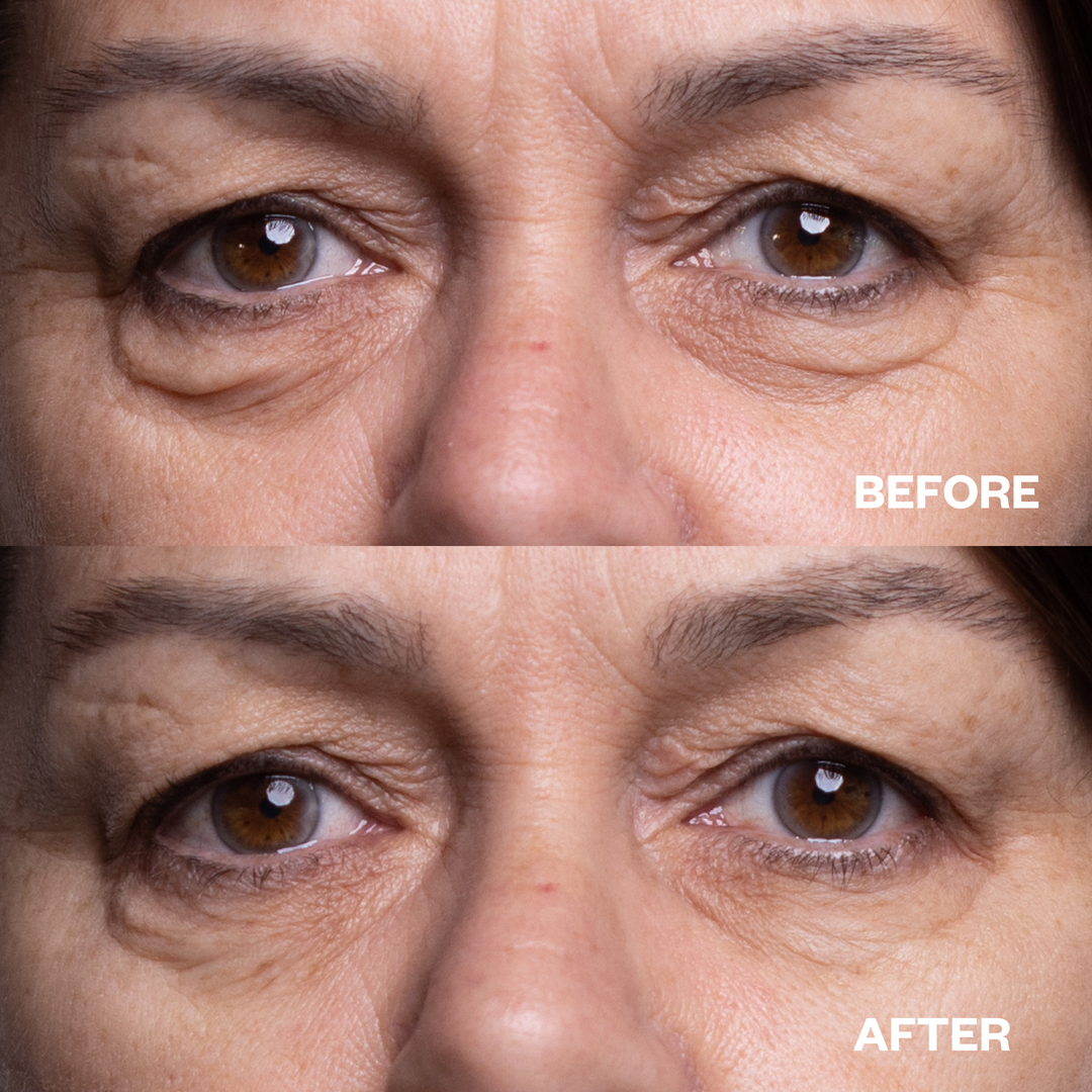 before_after_eyepatch